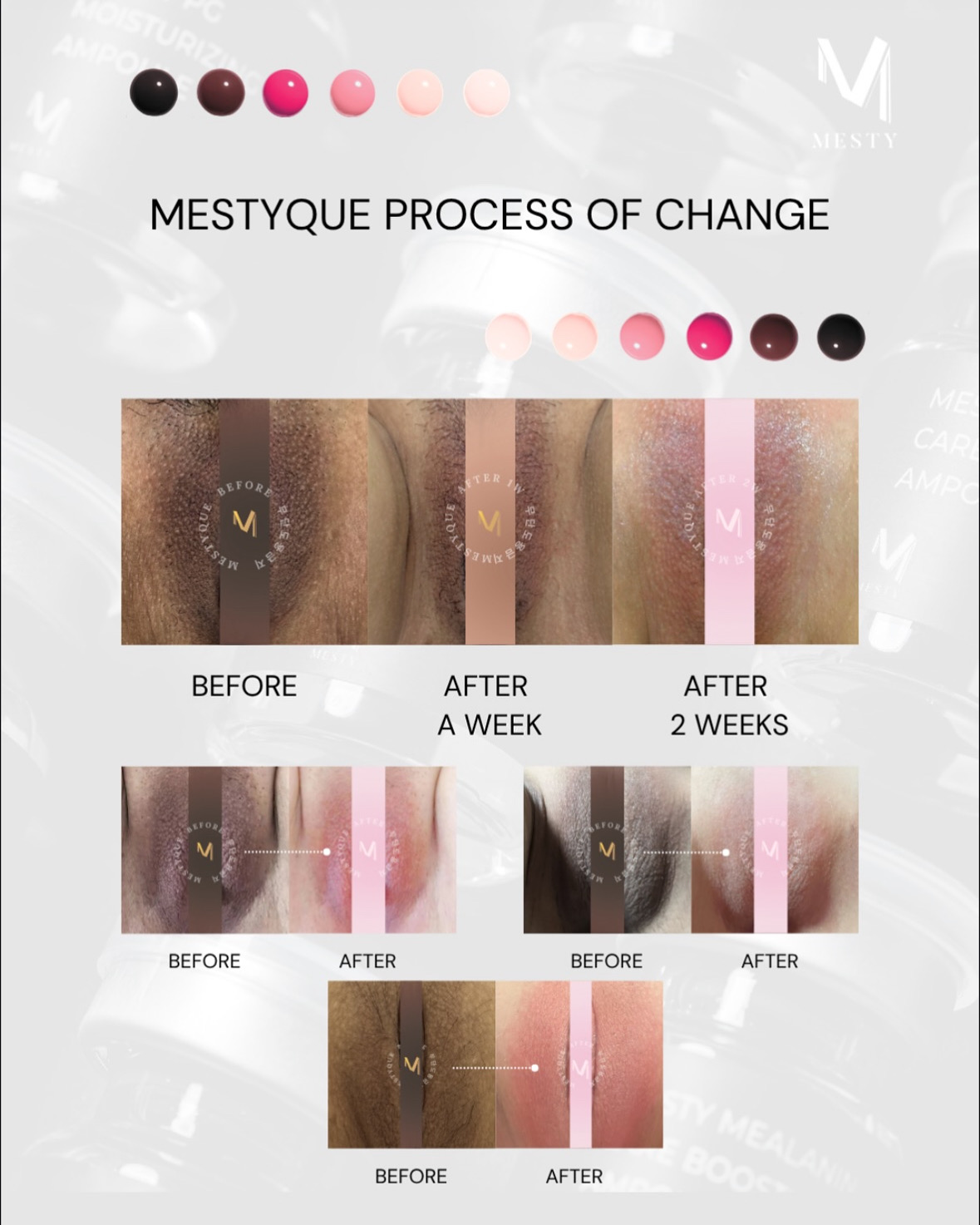 MESTYQUE
