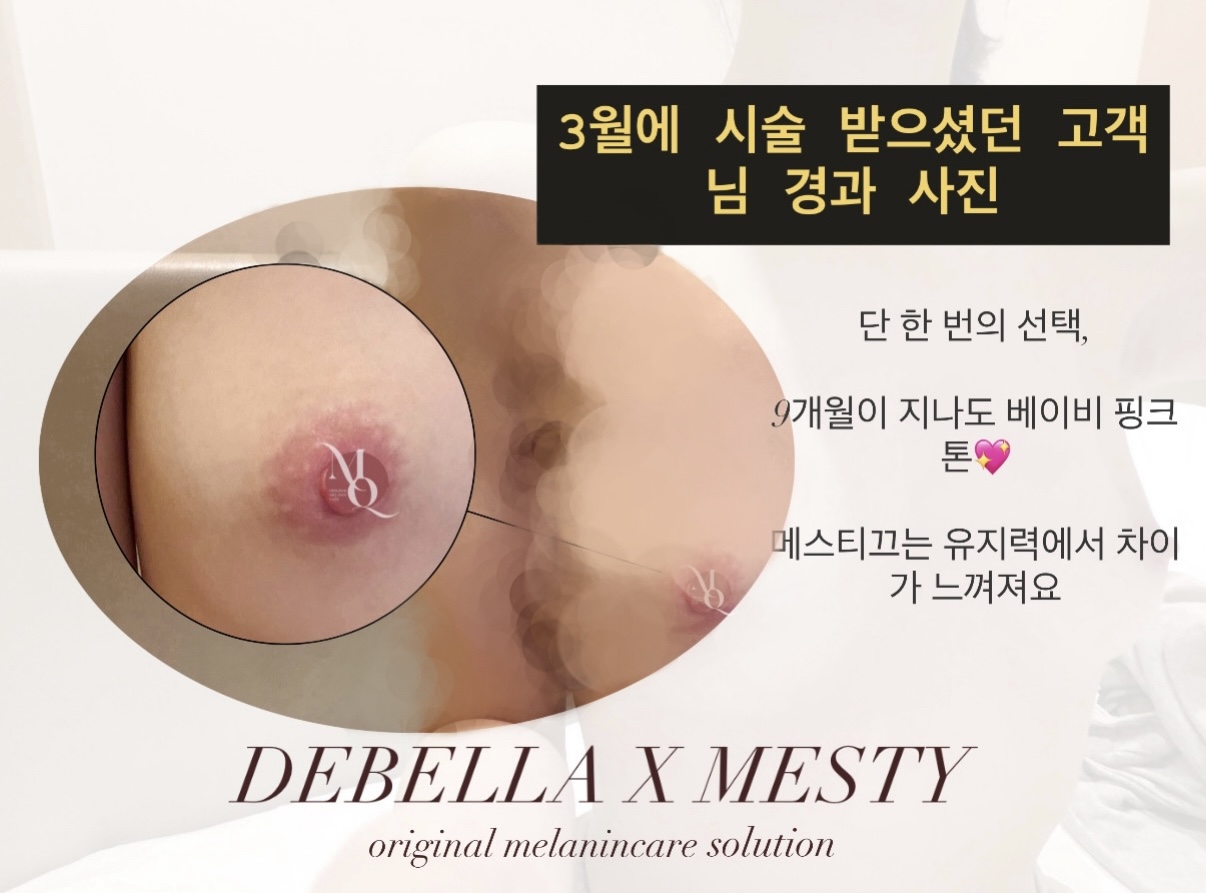 멜라닌케어 실제 후기 캡처