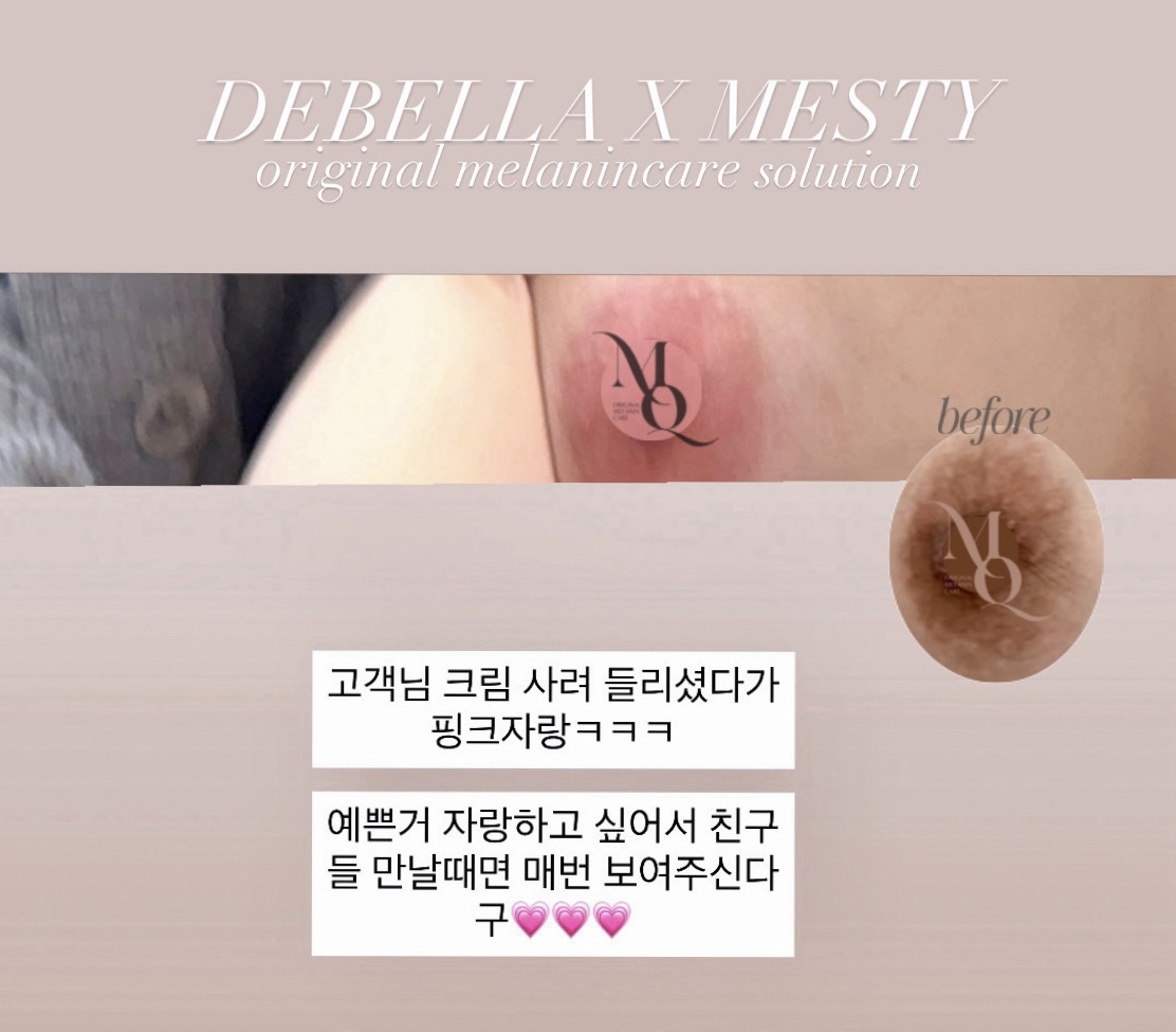 멜라닌케어 실제 후기 캡처