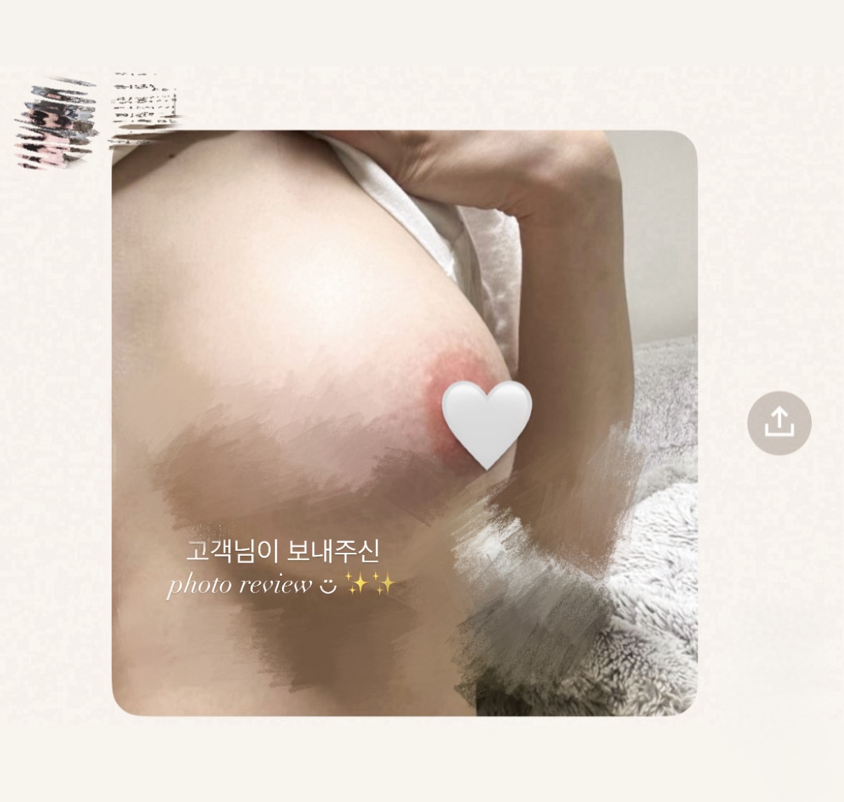 멜라닌케어 실제 후기 캡처