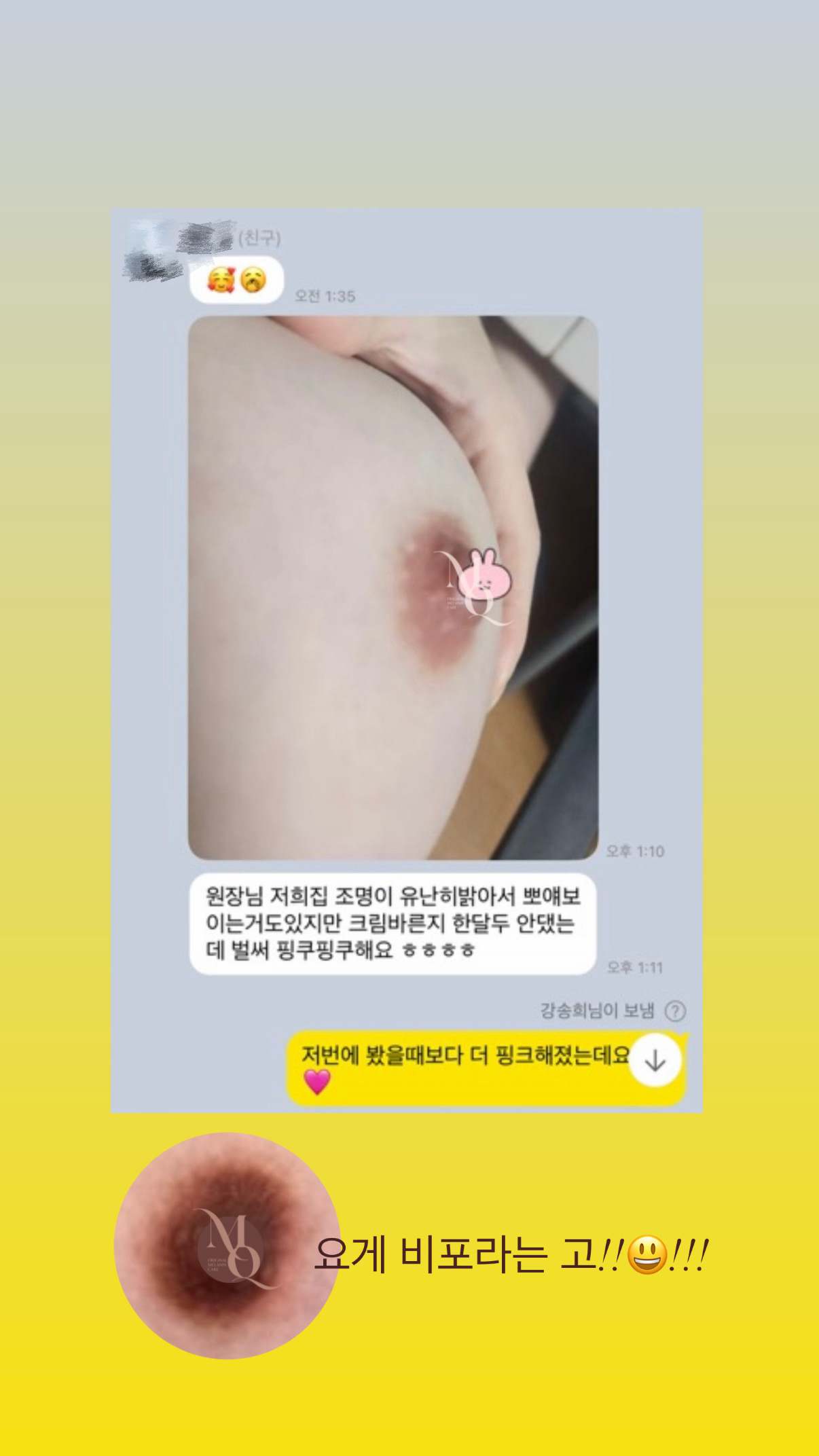 멜라닌케어 실제 후기 캡처