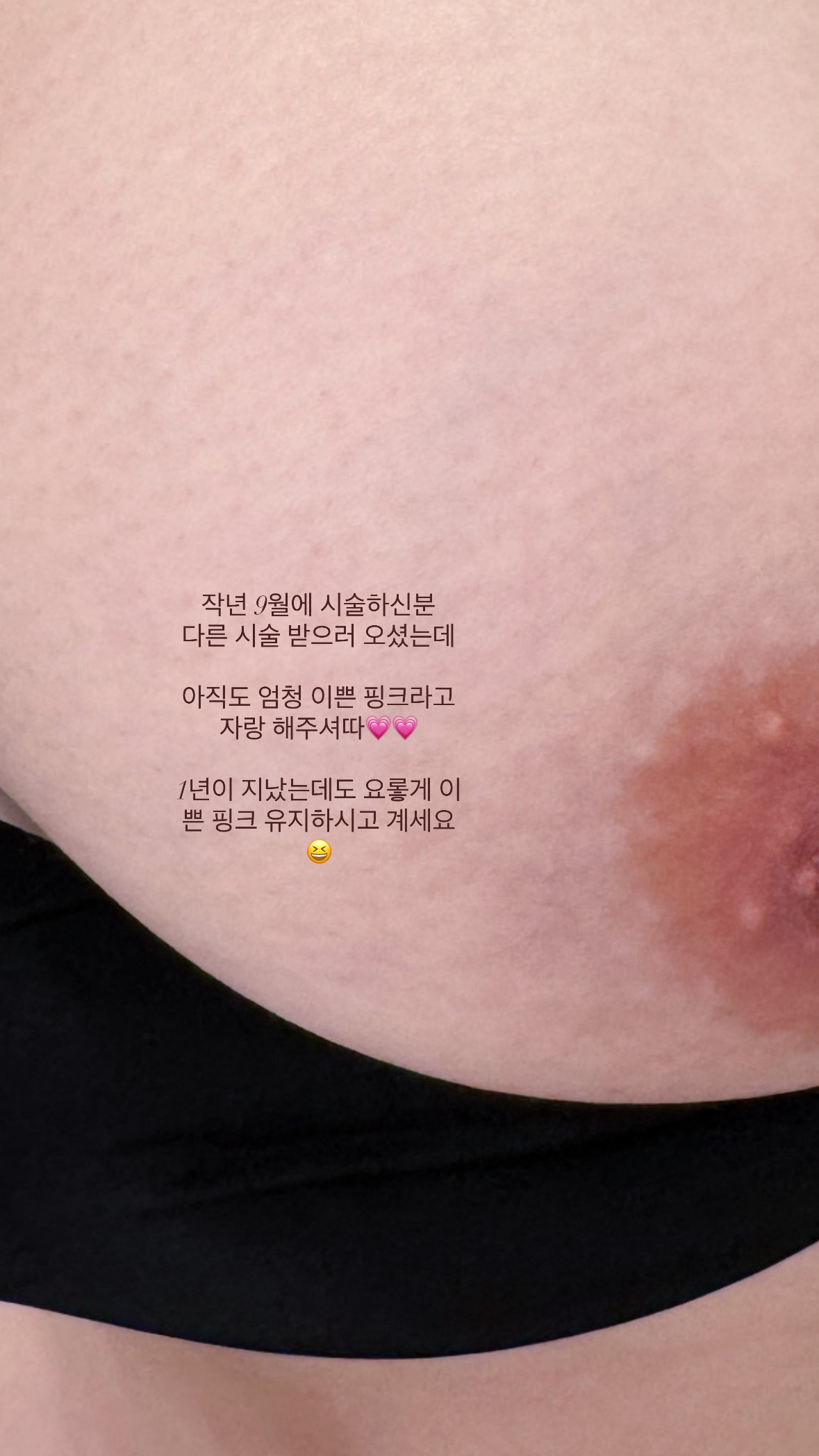 멜라닌케어 실제 후기 캡처