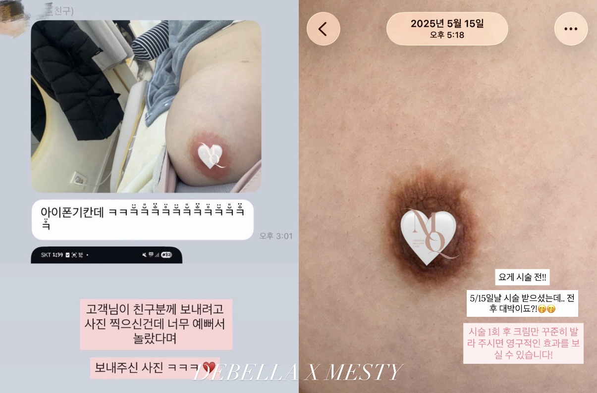 멜라닌케어 실제 후기 캡처