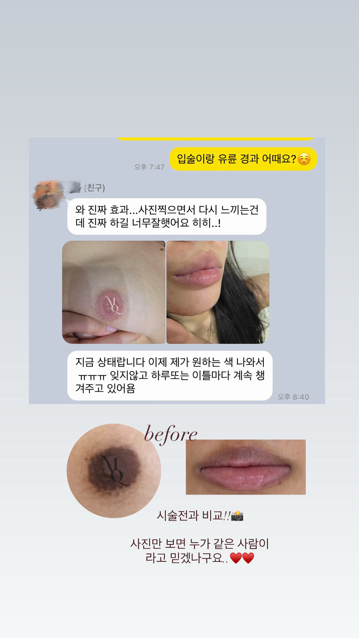 멜라닌케어 실제 후기 캡처