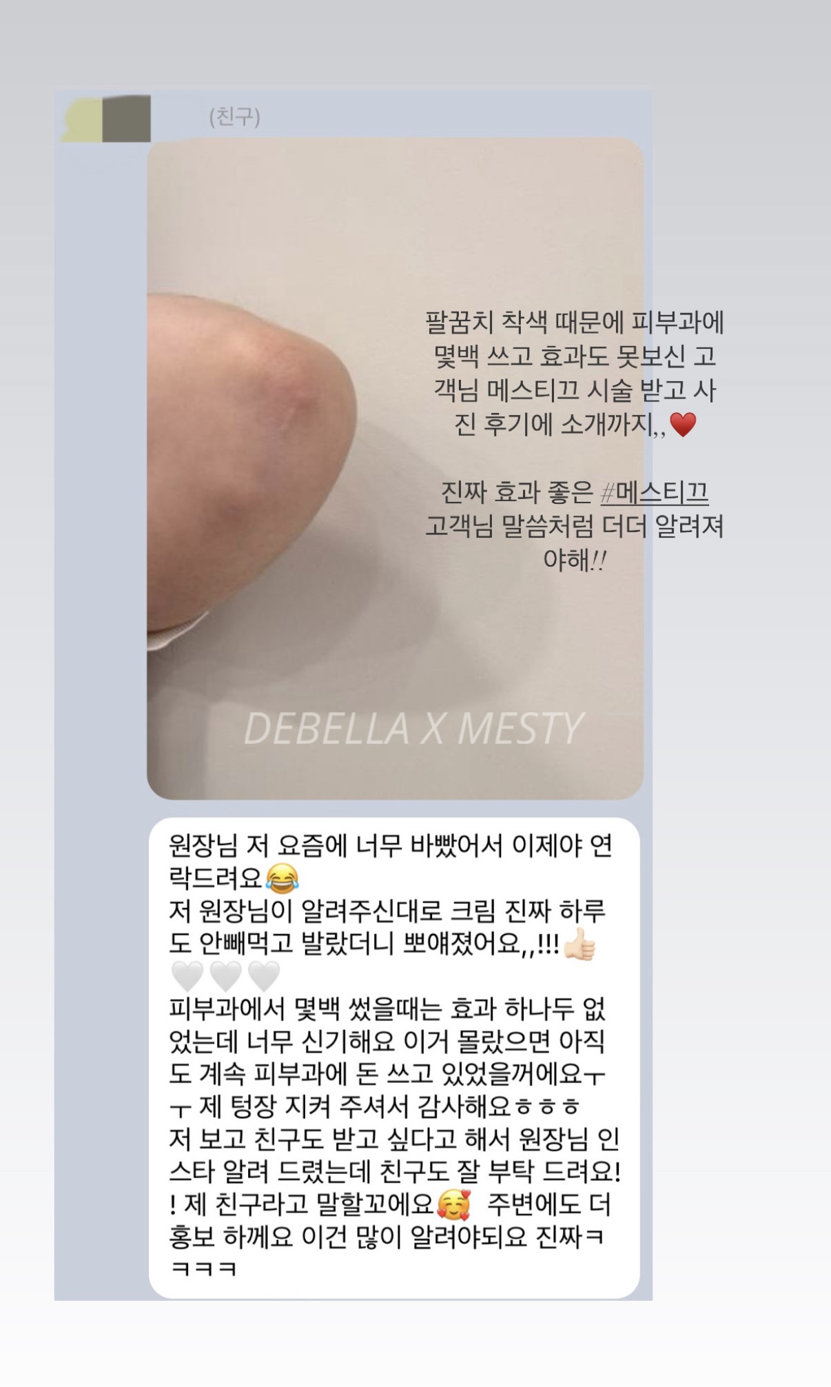 멜라닌케어 실제 후기 캡처